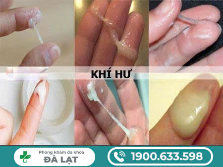 Hình ảnh minh họa